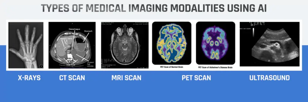 Medical Imaging Using AI