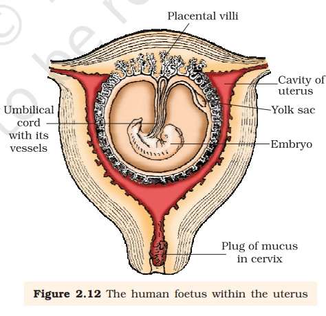 foetus in uterus